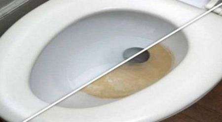 إليك هذه الحيلة الذكية للتخلص من ترسبات الحمام!