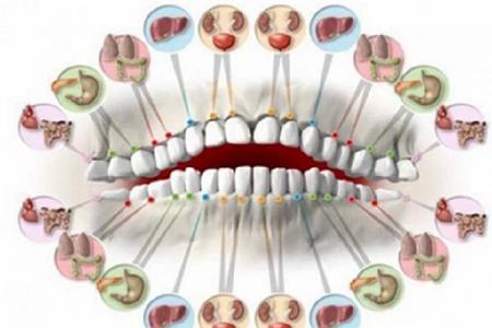 صورة كل ألم في أحد أسنانك ينبئ بمشاكل في بعض أعضاء جسمك