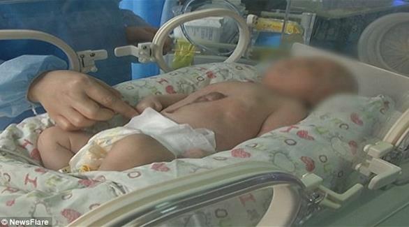 بالفيديو لحظة مؤثرة لطفل ولد بقلب خارج بطنه