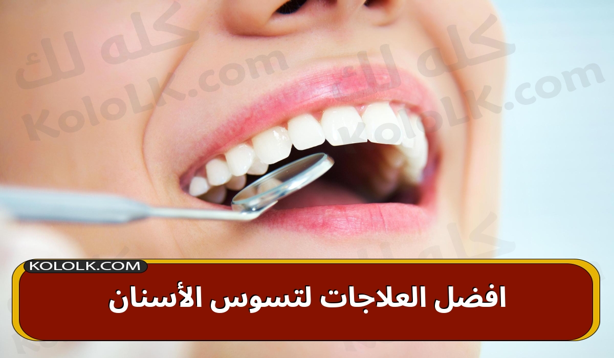 افضل العلاجات لتسوس الأسنان dental cavities لعام 2023