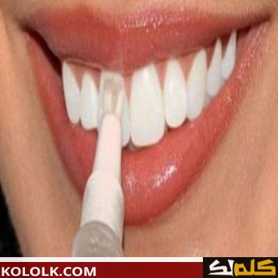 كيف يتم تبييض وتفتيح الاسنان