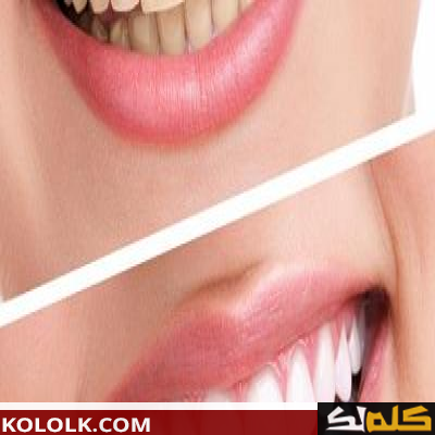 كيف يمكن تبييض وتفتيح الاسنان