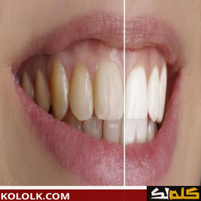 طرق ووصفات طبيعية لتبييض وتفتيح الاسنان