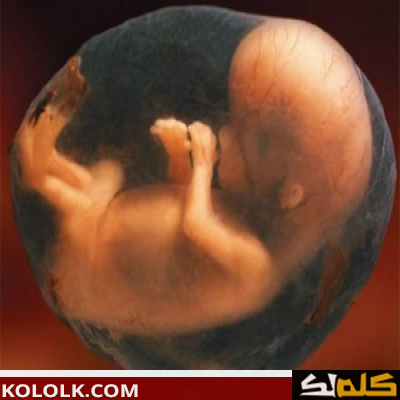 ما حكم اجهاض الجنين المشوه
