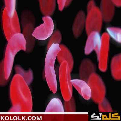 أنواع فقر الدم المنجلي