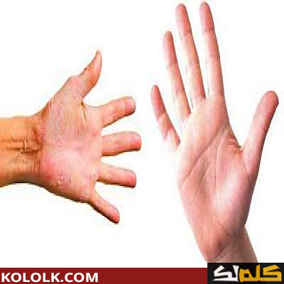 ما هي أسباب حساسية راحة اليد؟