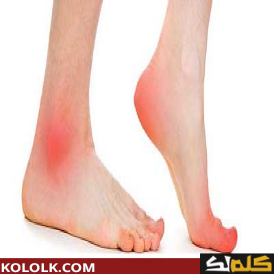 ما هى اسباب التهاب أعصاب القدم