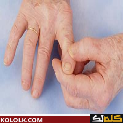 علاج و دواء تورم الأصبع
