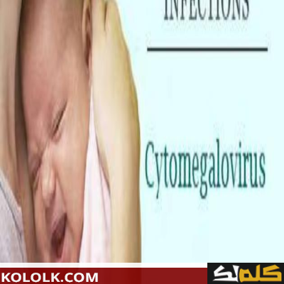 أعراض فيروس سيتوميجالو