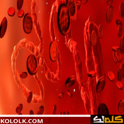 اسباب فقر الدم (الانيميا) و طريقة تشخيصه