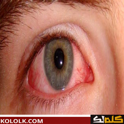 أمراض العيون وطريقة الوقاية منها