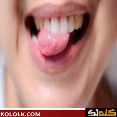 ما علاج و دواء الفطريات في الفم