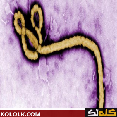 تعرف ما هو فيروس الايبولا