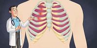 أعراض التهاب عضلات القفص الصدري