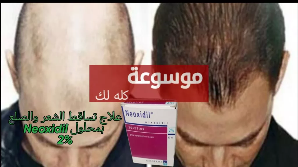 d8b9d984d8a7d8ac d8aad8b3d8a7d982d8b7 d8a7d984d8b4d8b9d8b1 d8a8d985d988d8a7d8af d8b7d8a8d98ad8b9d98ad8a9 d981d8b9d8a7d984d8a9 d985d988