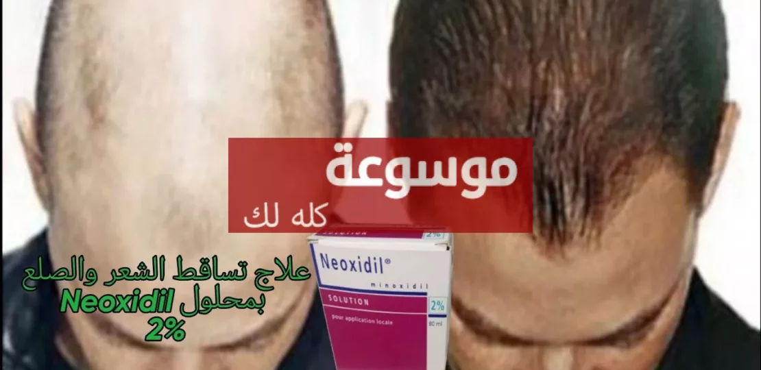 d8b9d984d8a7d8ac d8aad8b3d8a7d982d8b7 d8a7d984d8b4d8b9d8b1 d8a8d985d988d8a7d8af d8b7d8a8d98ad8b9d98ad8a9 d981d8b9d8a7d984d8a9 d985d988