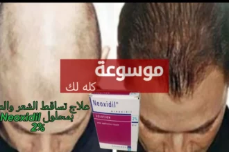 d8b9d984d8a7d8ac d8aad8b3d8a7d982d8b7 d8a7d984d8b4d8b9d8b1 d8a8d985d988d8a7d8af d8b7d8a8d98ad8b9d98ad8a9 d981d8b9d8a7d984d8a9 d985d988