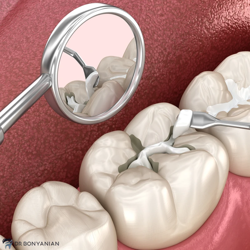 dental procedure medical complication