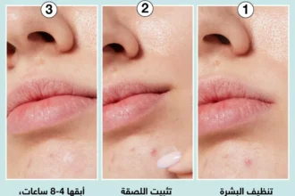 التخلص من البثور السوداء في الأنف بوصفات طبيعية آمنة وفعالة 10 blackheads nose natural remedy