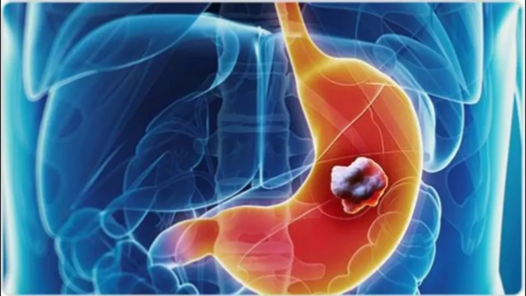 digestive system health doctor consultation screening