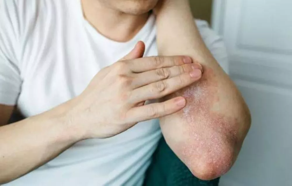 healthy food for skin inflammation