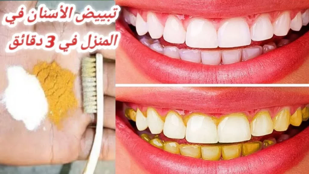natural teeth whitening