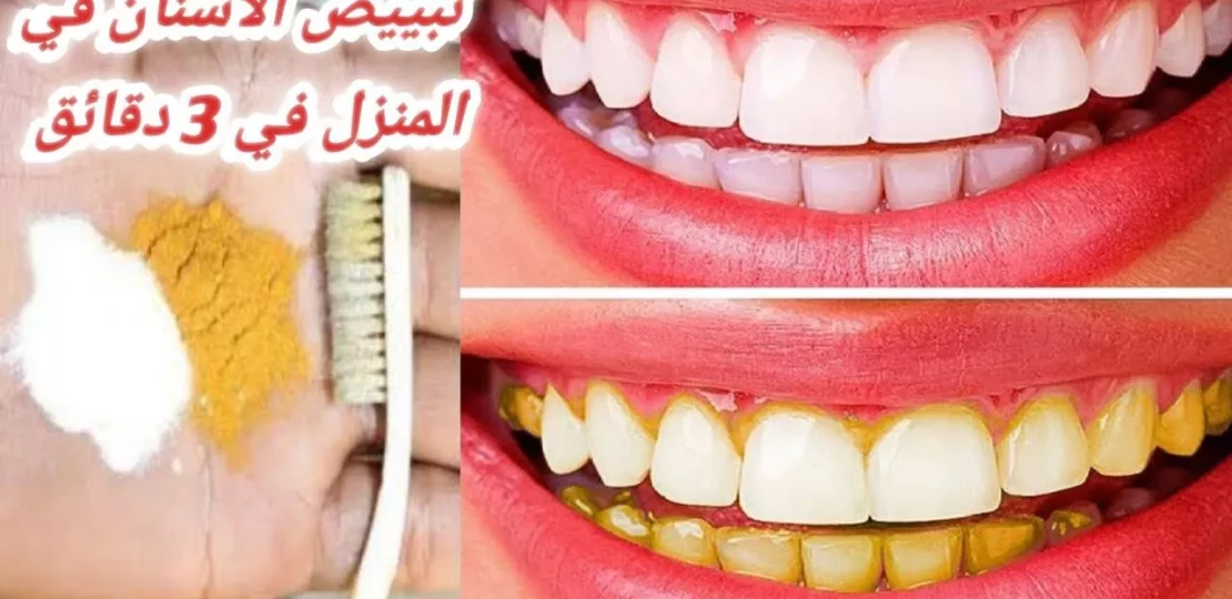 تبييض الأسنان طبيعيًا بطرق آمنة تمنحك ابتسامة مشرقة 1 natural teeth whitening