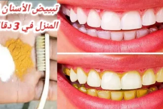 تبييض الأسنان طبيعيًا بطرق آمنة تمنحك ابتسامة مشرقة 8 natural teeth whitening