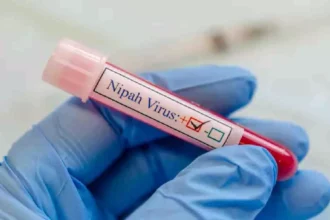 باكستان تبدأ فحوصات فيروس نيباه على الوافدين ضمن إجراءات صحية مشددة 6 Nipah virus health screening airport