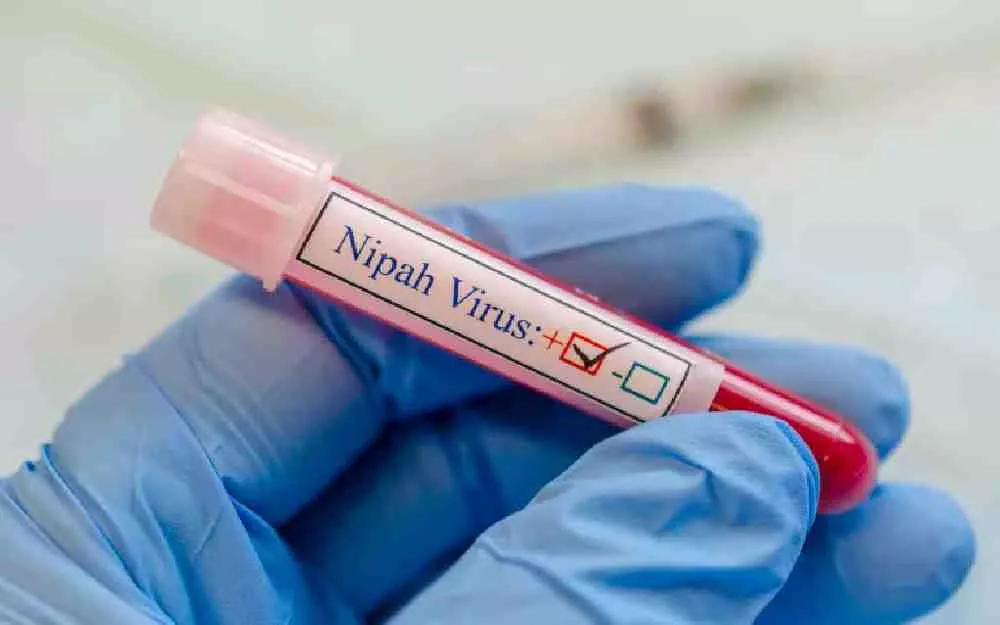 Nipah virus health screening airport