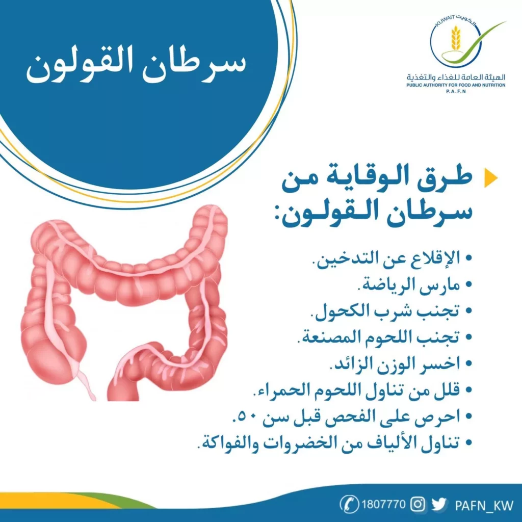 الوقاية من سرطان القولون