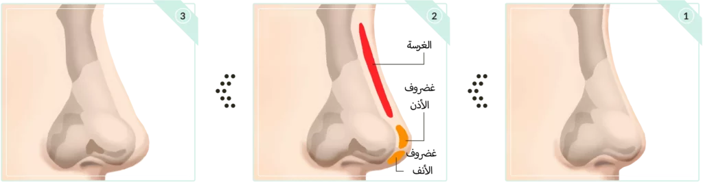 يرقات في الأنف