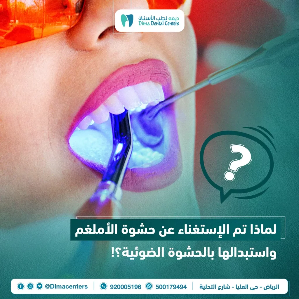 حشوات الأسنان المعدنية