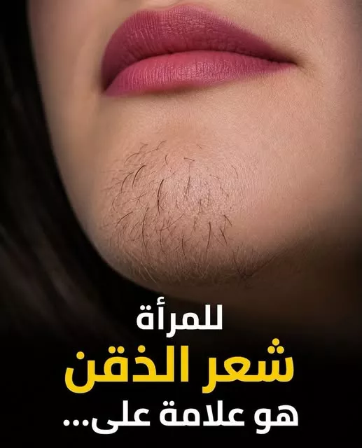 شعر الذقن عند النساء