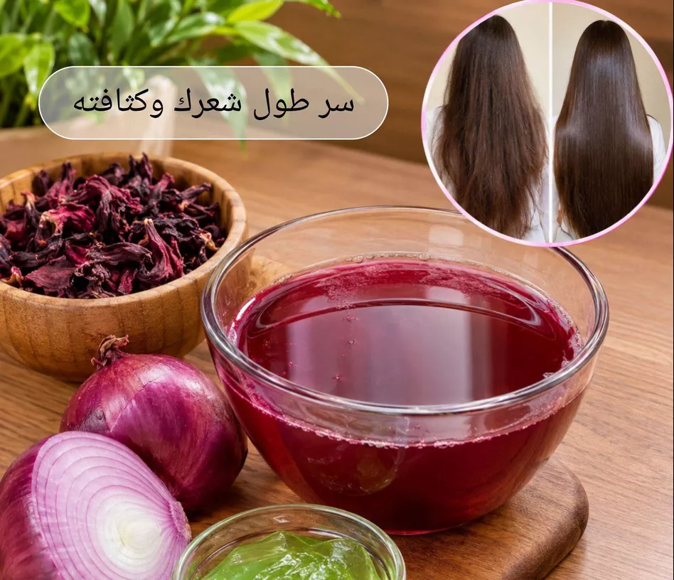 ماسك البصل والكركديه للشعر